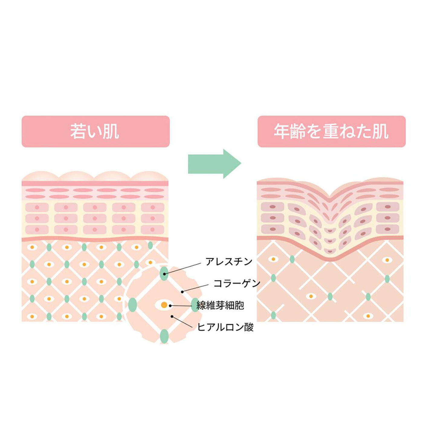 フェリシモギフトショップ|ＭＥＤＩＨＥＡＬ　フィトレチノールクリーム|年々肌のハリが減少する様子