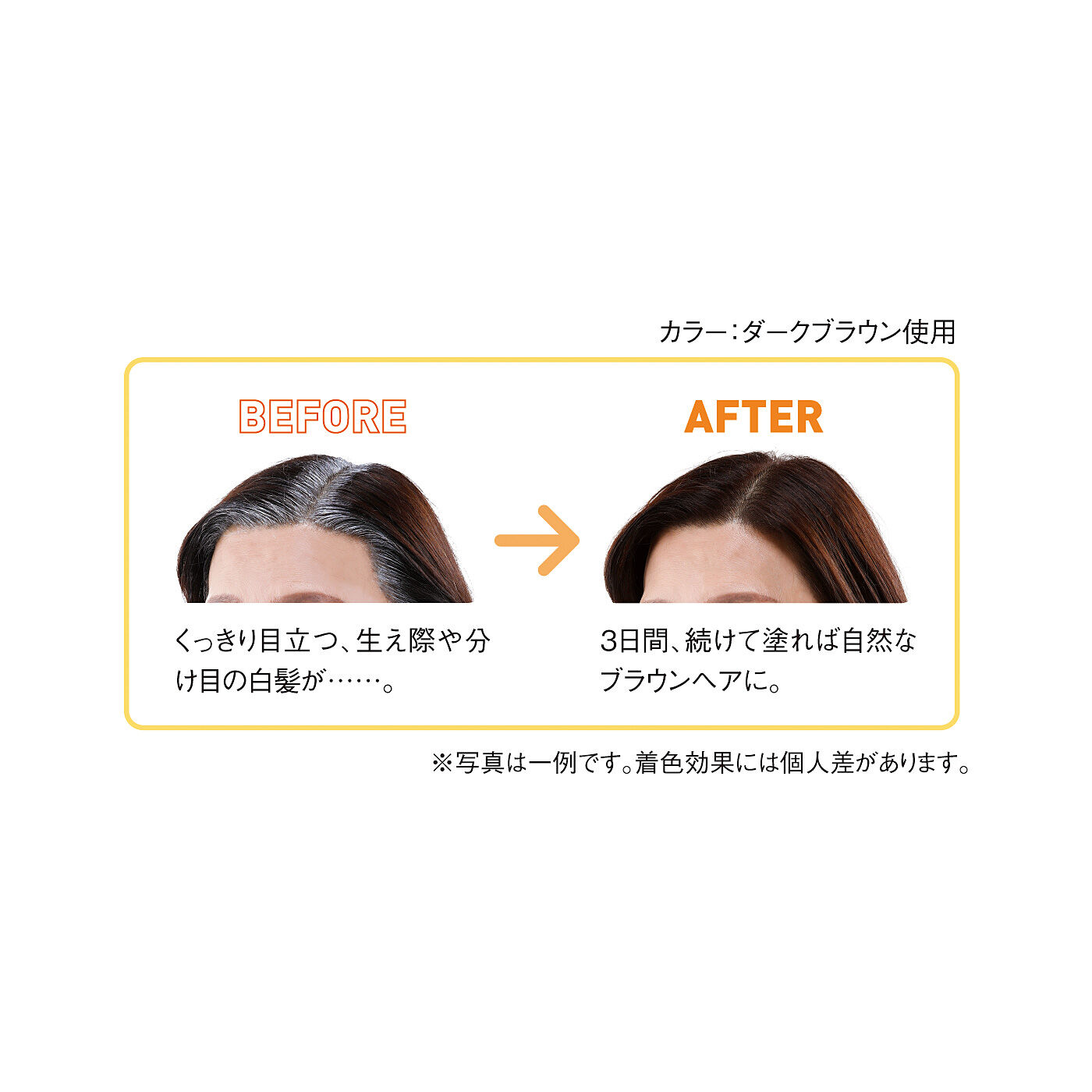 フェリシモギフトショップ|生え際白髪を狙い撃ち　クイックヤングヘアカラートリートメント〈ダークブラウン〉