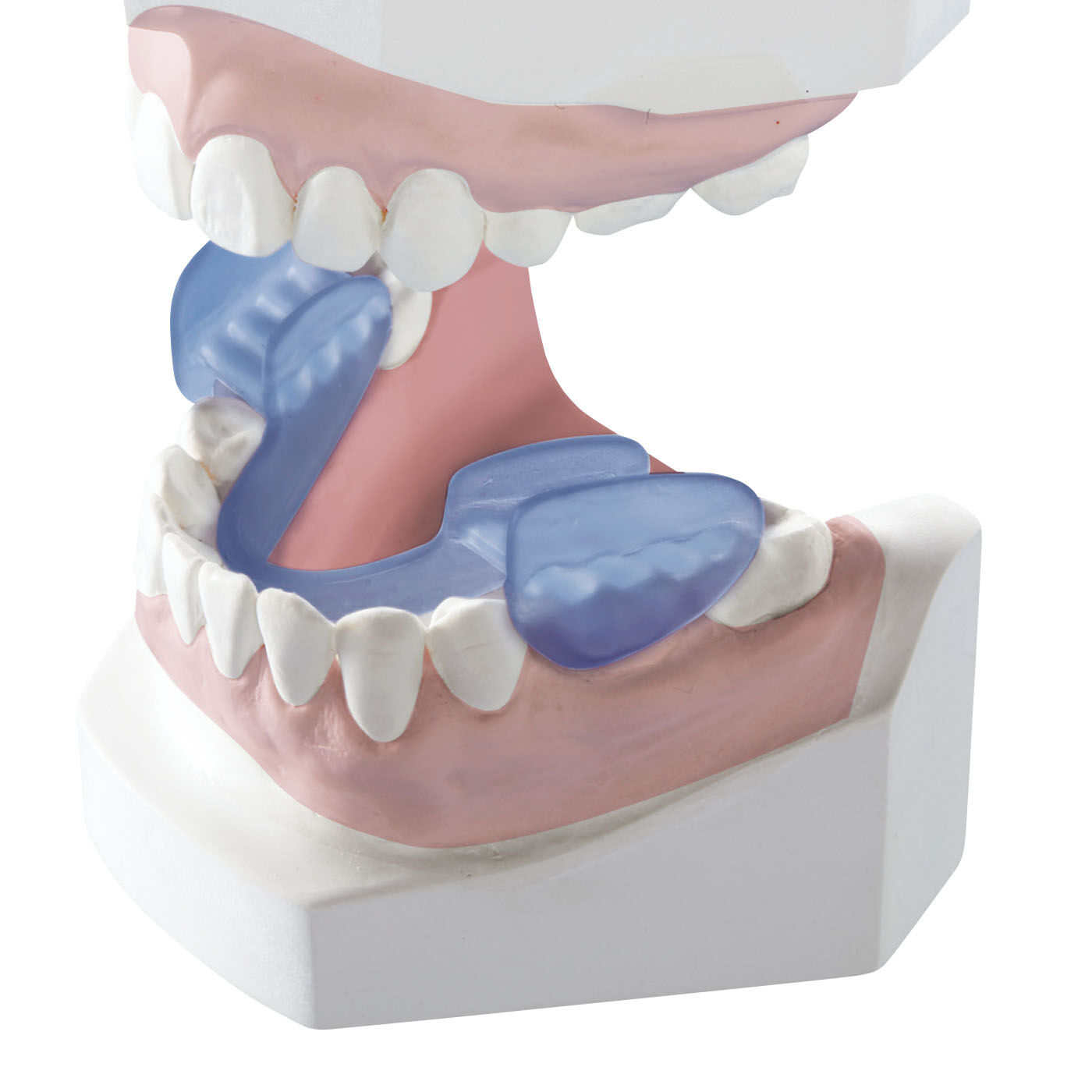 デンタルマウスピース 歯ぎしり 歯並び 口元ケア NEW 3段階でのケア - 4