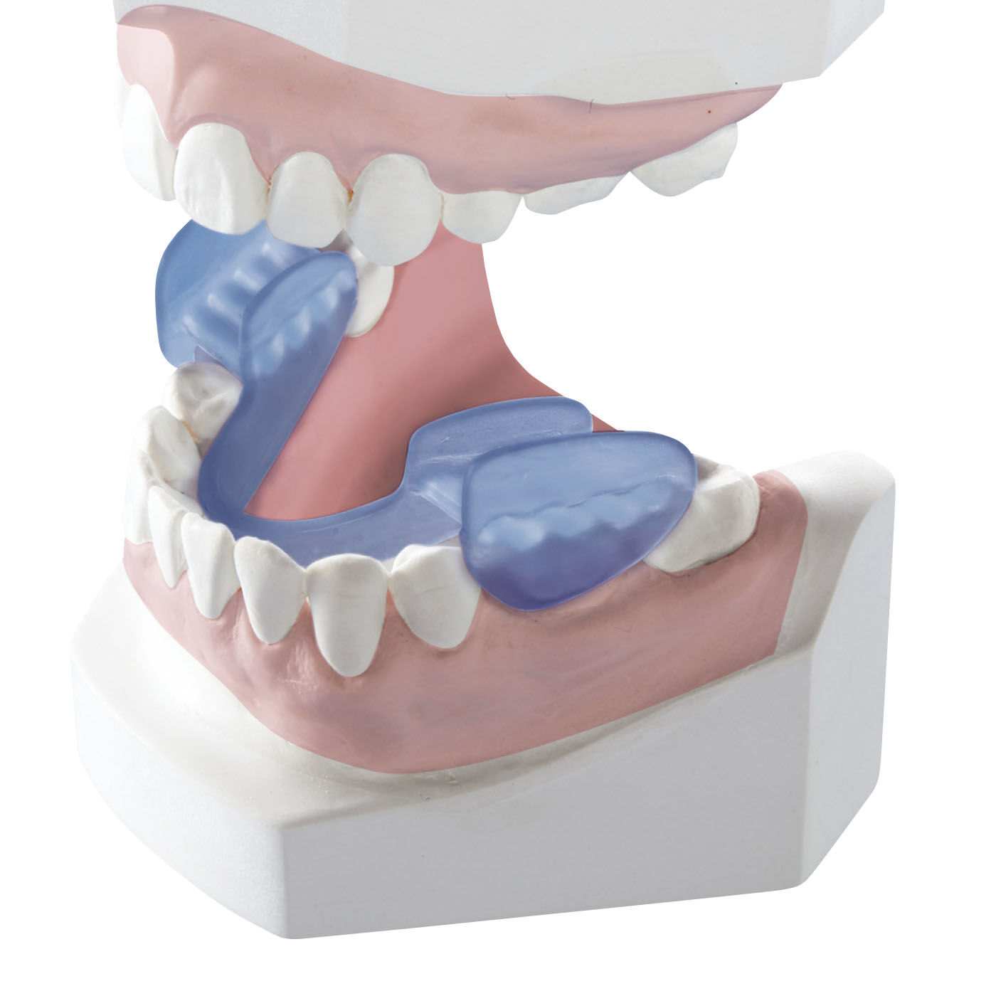 フラフィール|波形状シリコーンが 歯圧を吸収！ 歯ぎしり対策マウスピース|奥歯にはめるだけのタイプなので、全体に装着するものよりも違和感が少なく快適に装着できます。