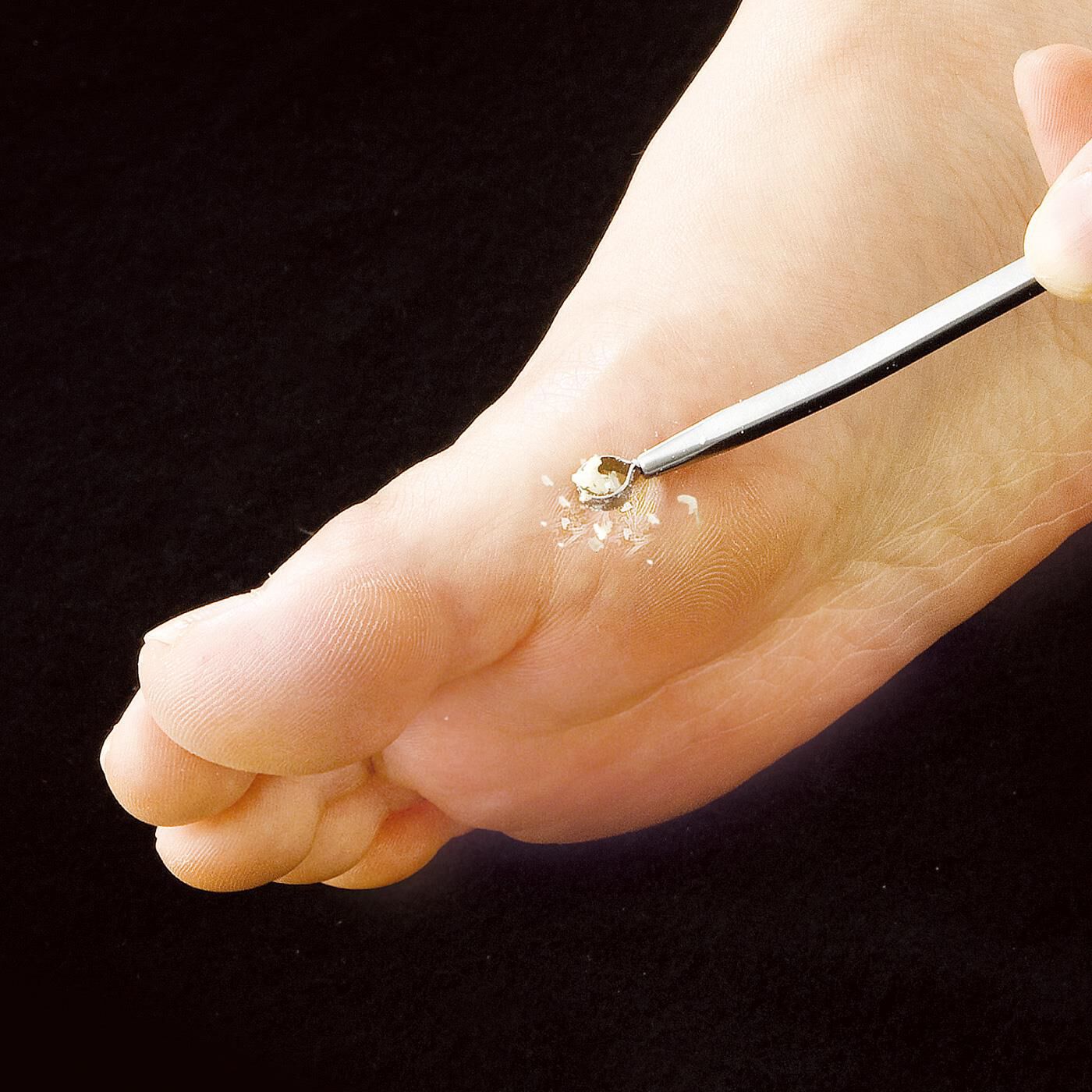 flufeel|ガサガサした足裏角質　軽くこすって滑らかに　ダイヤモンド粒子加工ピュアスリック|足の側面や指の付け根など、厚くなりがちな角質を狙ってポロポロ。