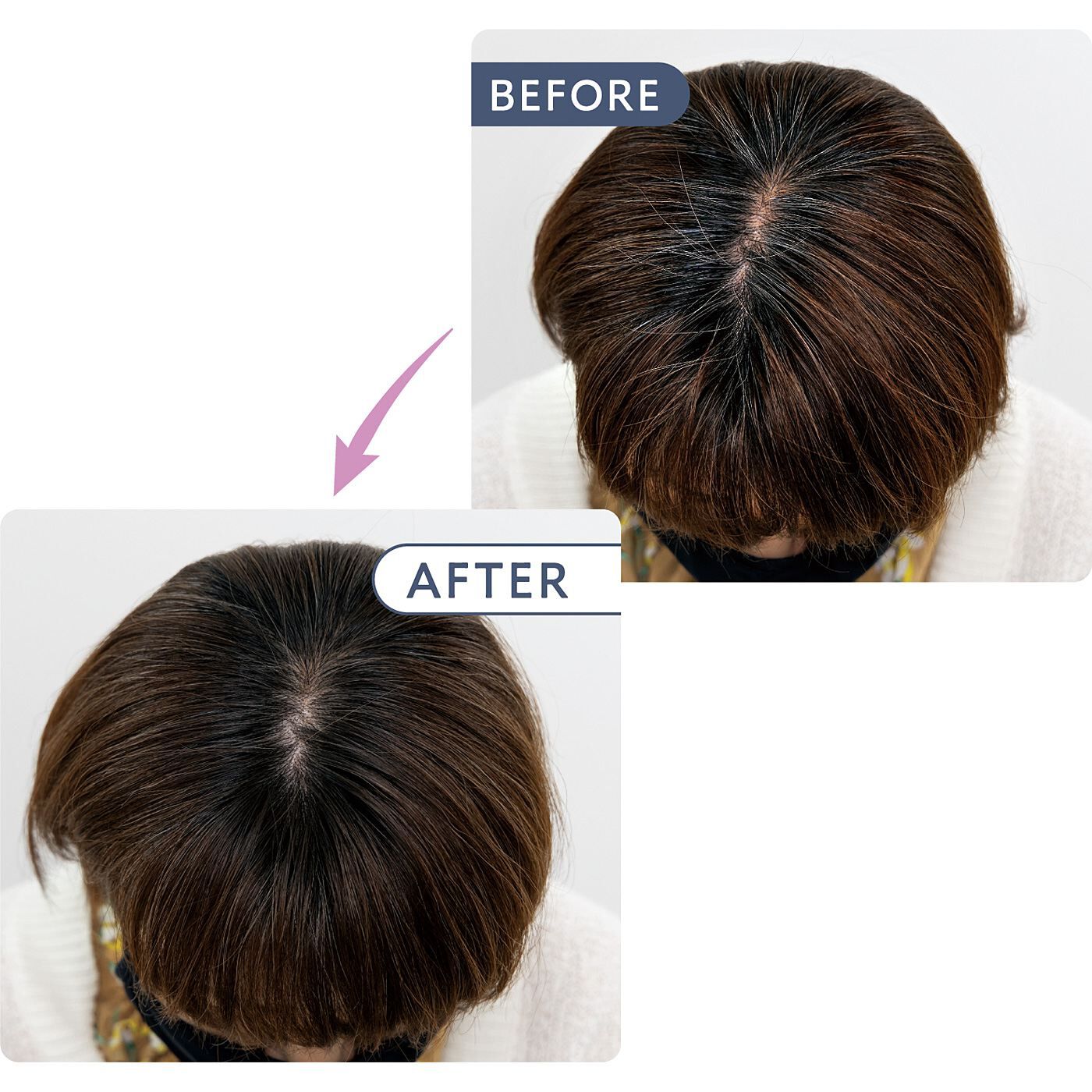 フェリシモの雑貨 Kraso|白髪も薄毛もささっとケア　ヘアファンデーション〈ブラック〉の会|白髪が目立つ頭頂部も、ファンデーションでしっかいカバー＆ボリュームアップ！※写真は一例です。着色効果には個人差があります。※ダークブラウンを使用。