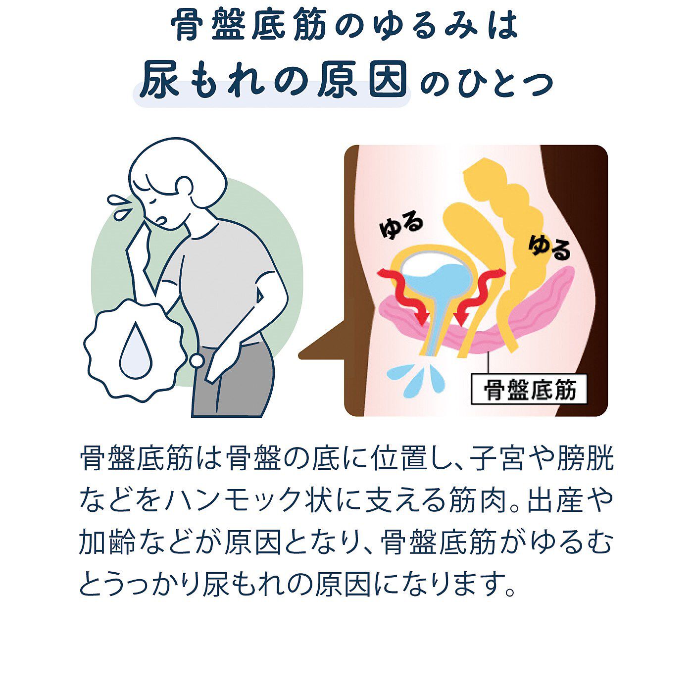 フェリシモの雑貨 Kraso|尿もれ・頻尿対策に！　ショーツの上から骨盤底筋の引き上げアシスト　メディカルサポーター〈ローズベージュ〉の会